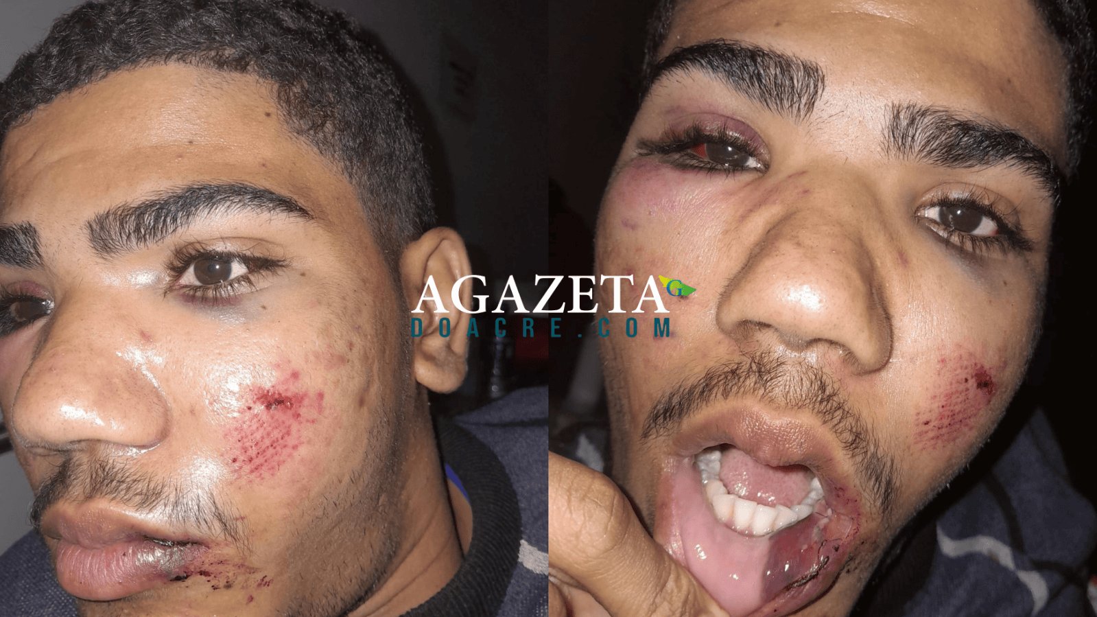 Aluno é espancado na saída de escola no Acre após sofrer bullying, denuncia família